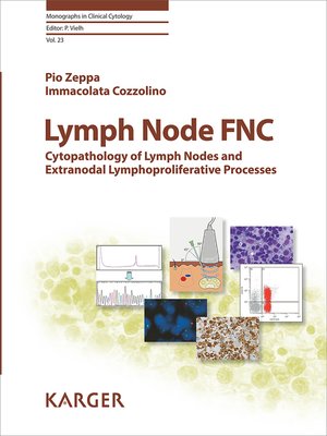 cover image of Lymph Node FNC